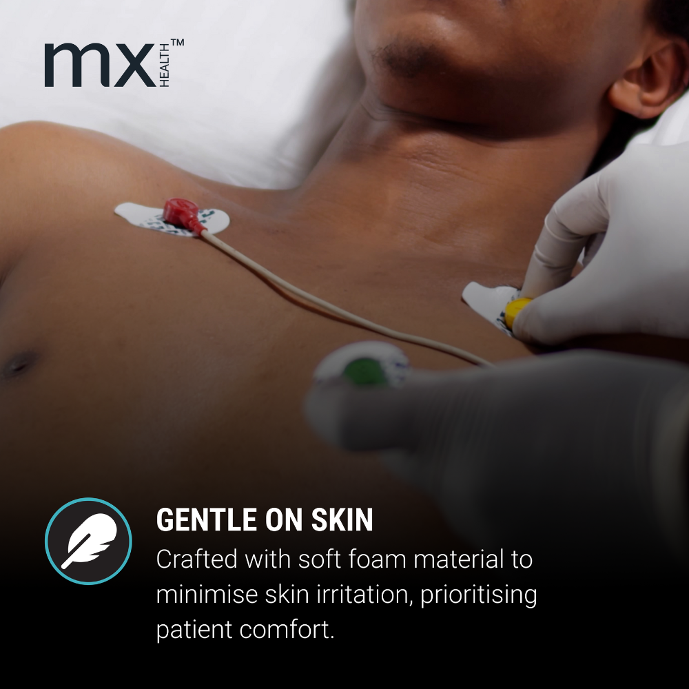 Mx Disposable Ecg Electrodes Pregel Ag/Agcl Sensor - Image 2